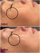 ソルエユニーク(Le seul et unique)/トーンアップ・ハリ・艶★