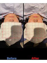 松戸駅前鍼灸院 整骨院/小顔矯正/オイル/マッサージ