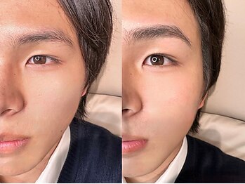 フイ(hui)の写真/眉毛のお悩みは人それぞれ…プロが黄金比から作る美眉で出会って3秒の印象を変える◎