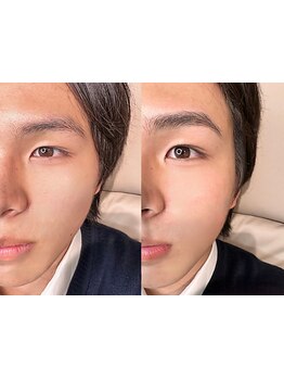 アイブロウメニューがあるサロン