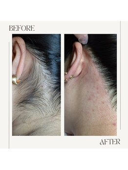 スプランドゥール(Splendeur)/レディース【うなじ】 Wax+光