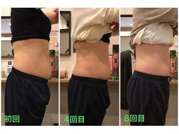 柏の葉オレンジ整体院/スマートスカルプトお腹スッキリ