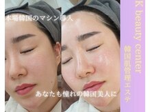 ケイビューティーセンター(K beauty center)