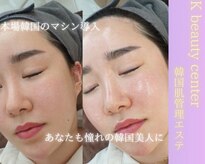 ケイビューティーセンター(K beauty center)
