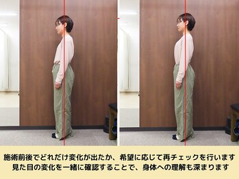 ルピナス整体院/姿勢のチェックをします
