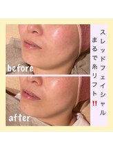 アールアンドエス(R&S)/スレッドフェイシャル