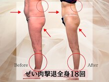 ハナチュチュ 矢場町店(Hanachuchu)/