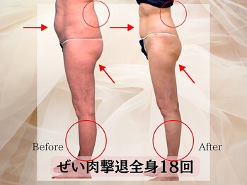 ハナチュチュ 矢場町店(Hanachuchu)/