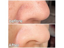 ミラ 中央林間(mira)の雰囲気（国家資格保持[小顔/毛穴/ホワイトニング］）