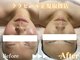 ルベル(Luvelle)の写真