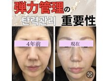 アイリー(IRIE)の雰囲気（ニキビ肌質改善はアイリーにお任せ下さい★）