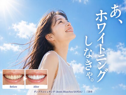 ダンブランシュサンダ(dents Blanches SANDA)の写真