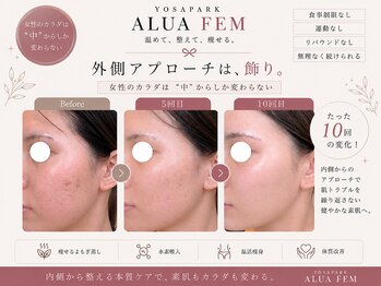 ヨサパーク アルア フェム(YOSA PARK ALUA FEM)/インナーケアで圧倒的変化