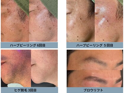 レオンザビューティー(REON the BEAUTY)の写真