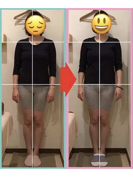 なぎさ整骨院/産後骨盤矯正10回目