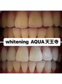 アクア 天王寺店(AQUA)&nbsp;セルフホワイトニング/大阪/天王寺/小顔/ホワイトニング/美白