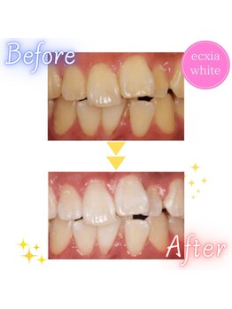 エクシアホワイト SOKA(ecxia white)/