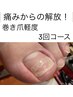 巻き爪（軽度）の痛みでお悩みの方へ☆巻き爪ケア1本3回コース¥22000→¥17000