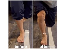 カワル整体 上通り院/足トラブルの解消法