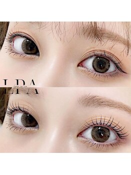 レピア 郡山駅前店/韓国式LEPIA Before&After