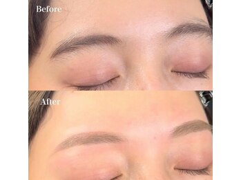 ブリス 姫路(Bliss)/お客様Before/After