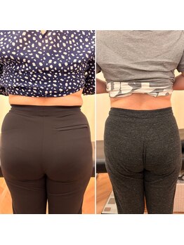 ナオ接骨院(NAO接骨院)/Before/After