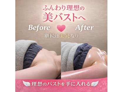 オンユ(Onyu)の写真