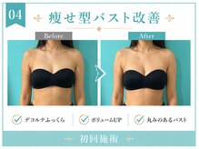 ネイト ワックス(Neit Wax)/痩せ型バスト改善◎
