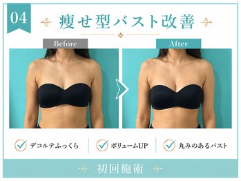 ネイト ワックス(Neit Wax)/痩せ型バスト改善◎