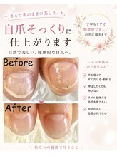 グラシナ 名古屋金山店/(深爪／長さだし/フィルイン)