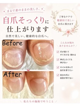 グラシナ 名古屋金山店/(深爪／長さだし/フィルイン)