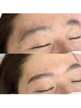 ラ フルール(La Fleur)/ハリウッドブロウリフト