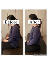 ワン ストレッチ(ONE stretch)/３０代女性before・after