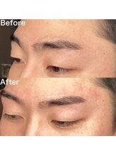 眉毛ハウス 吉祥寺店(眉毛HOUSE)/お客様の施術例(吉祥寺/東京)