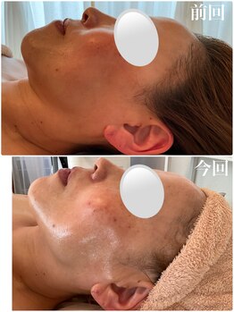 美バストアルファ(美bust α)/【小顔コルギ&バストアップ】