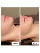 ベル(belle)/【小顔】レモンボトル♪