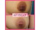アロハーブの写真