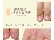 グレースレディ