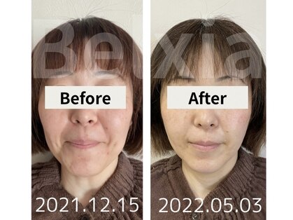 ベルシア(Belxia)の写真