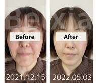 ベルシア(Belxia)