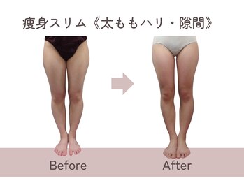 ティファニー/痩身スリム