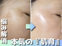 【シミ・ニキビ・毛穴専門店】Bell skin