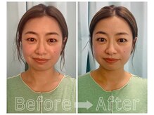 整体アンド矯正 施術研究所 ケアラボ(carelabo)の雰囲気（鏡を見てすぐ効果を感じる即効性！継続することでより効果UP！）