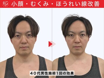 顔ジム 麻布十番店/