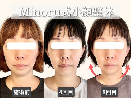 フレキシボディ(FlexiBody)の写真