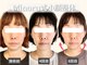 フレキシボディ(FlexiBody)の写真