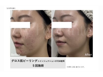 ティンク 心斎橋(Tink)の写真