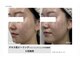 ティンク 心斎橋(Tink)の写真