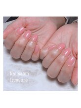 トレジャー(treasure)/