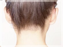 ラリュール(L'Allure)/最新脱毛でうなじ美人♪